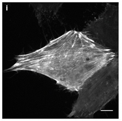 mCyRFP Labeled Actin Cytoskeleton