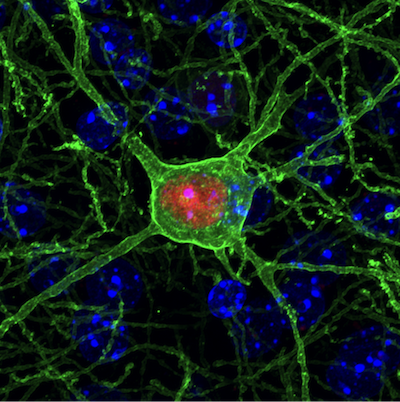 GABA-ergic Interneuron
