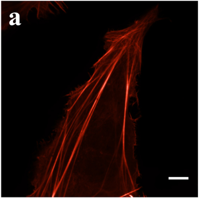 mScarlet labled F-Actin
