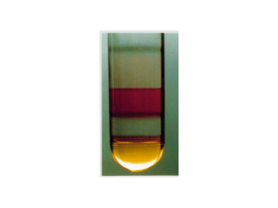 iodixanol gradient before centrifugation