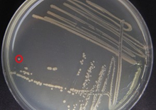 Streak Bacterial Plate Photo