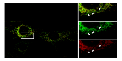 MitoTimer-plasmids-Roberta-Gottlieb-and-Zhen-Yan.png